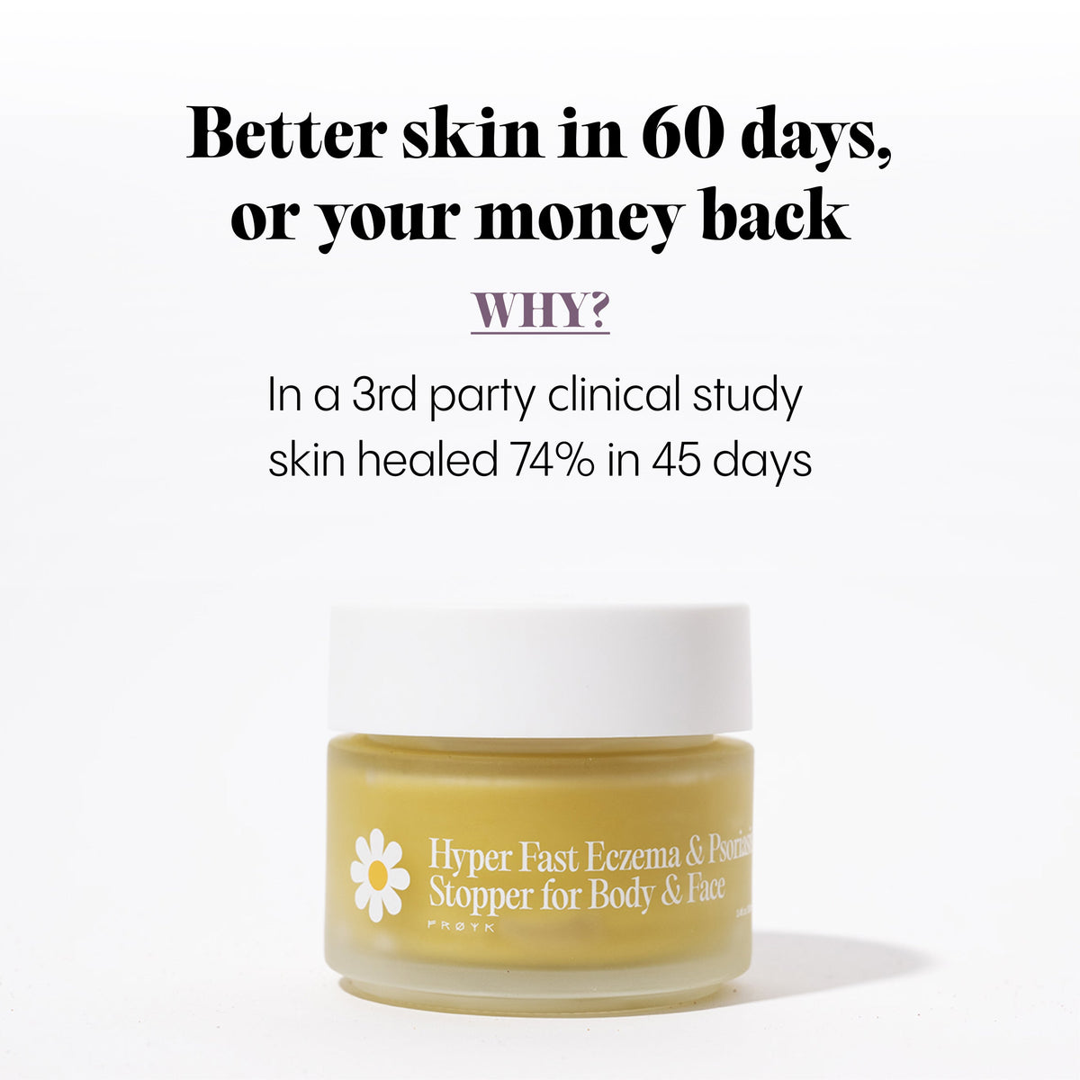 Dry and Itchy Balm for Face and Body