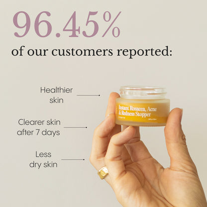 The Complete System for Acne-Prone Skin